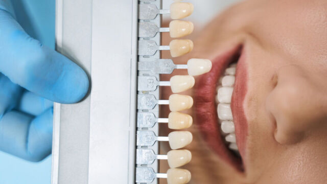 Czy implanty stomatologiczne mogą być stosowane u osób z cukrzycą?